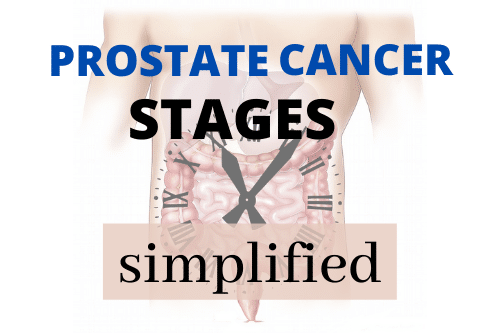 Prostate Cancer Stages Simplified Pro Doctor 