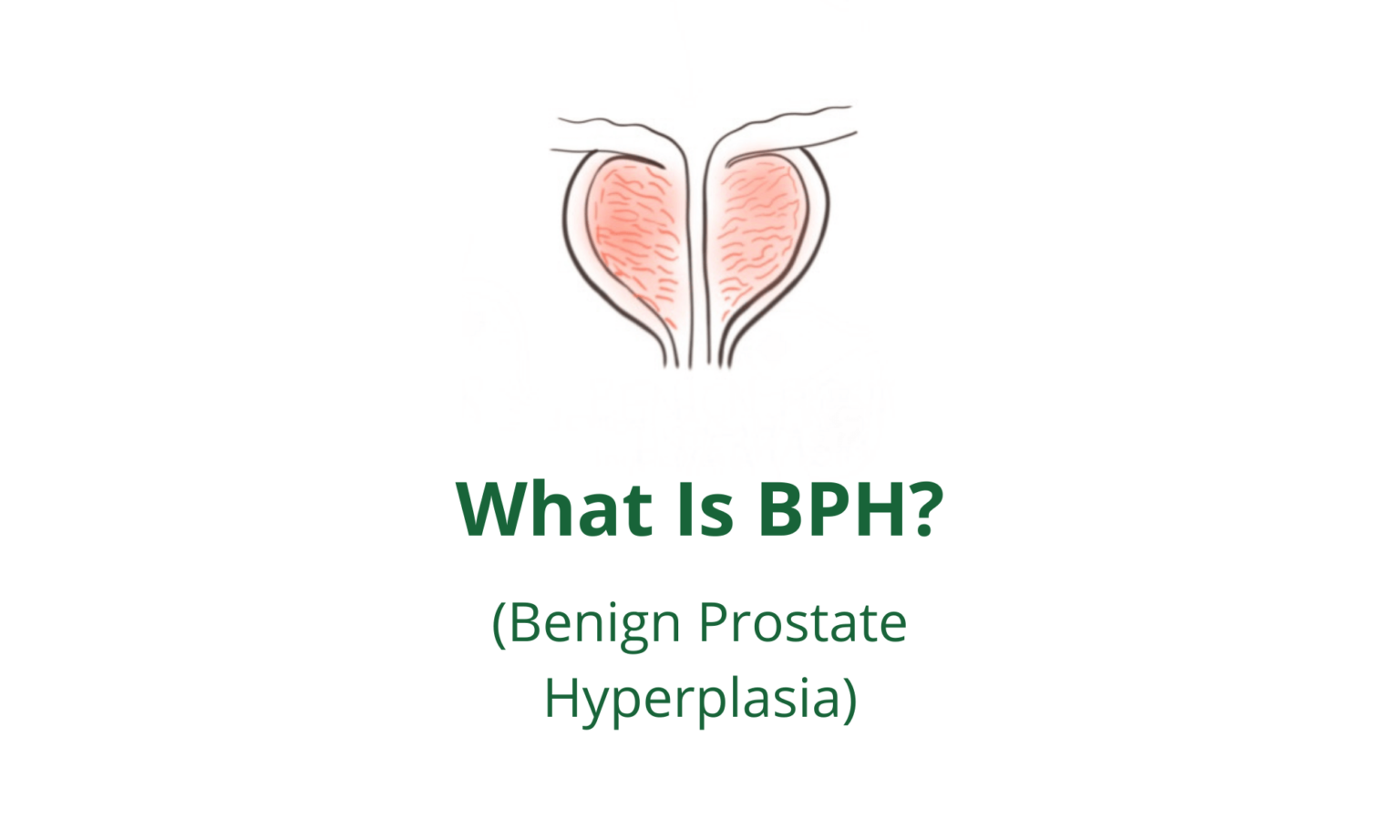 What Is Benign Prostate Hyperplasia? - Pro doctor
