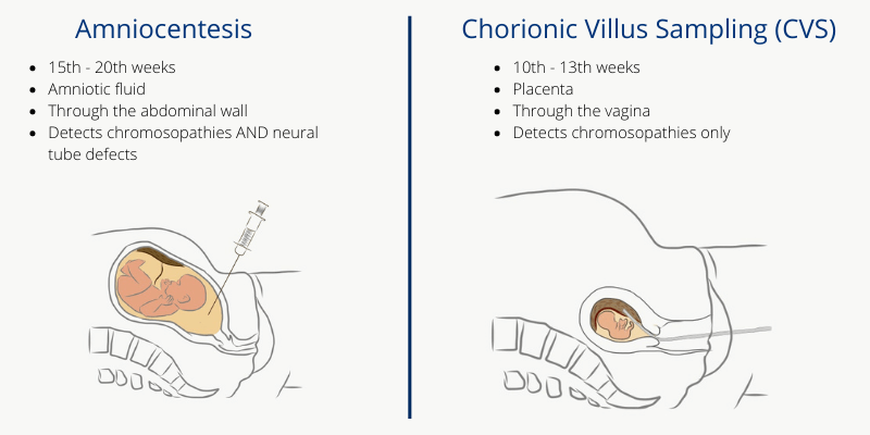 Comparison between Amniocentesis and Chorionic Villus Sampling