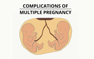 Pregnancy Complications: When Things Go Wrong - Pro Doctor