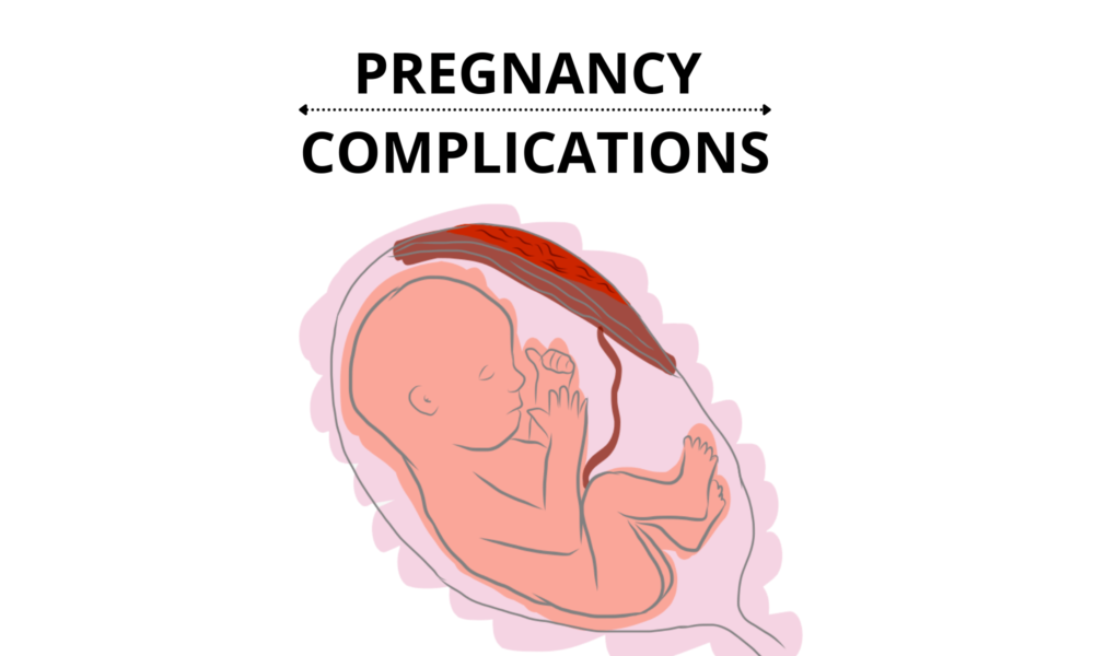 Pregnancy Complications: When Things Go Wrong - Pro Doctor