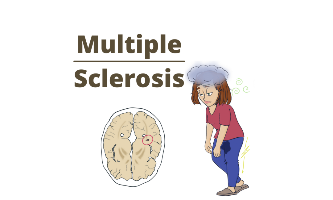 Amyotrophic Lateral Sclerosis (als) 