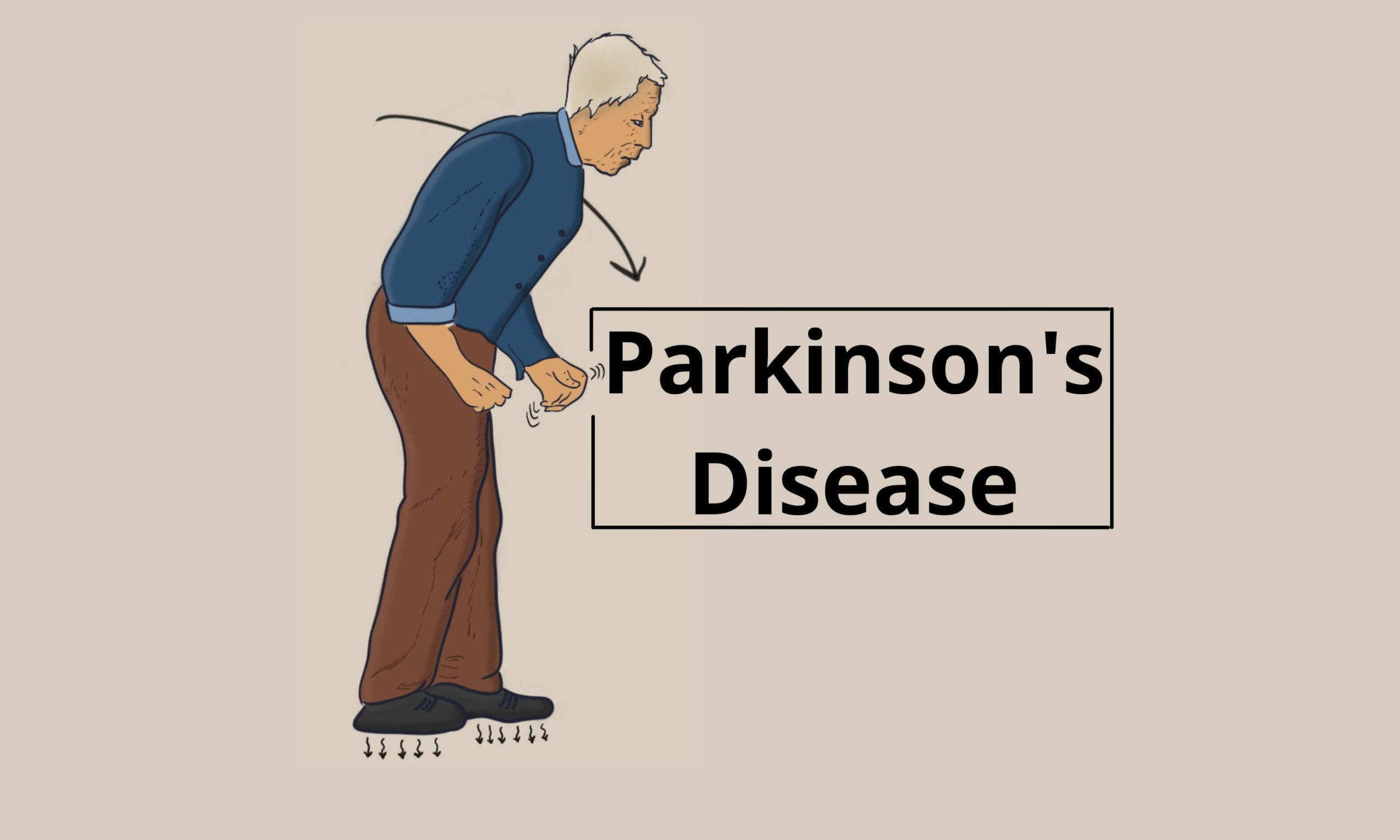 Parkinson's Disease: symptoms, how to diagnose and treat it - Pro doctor