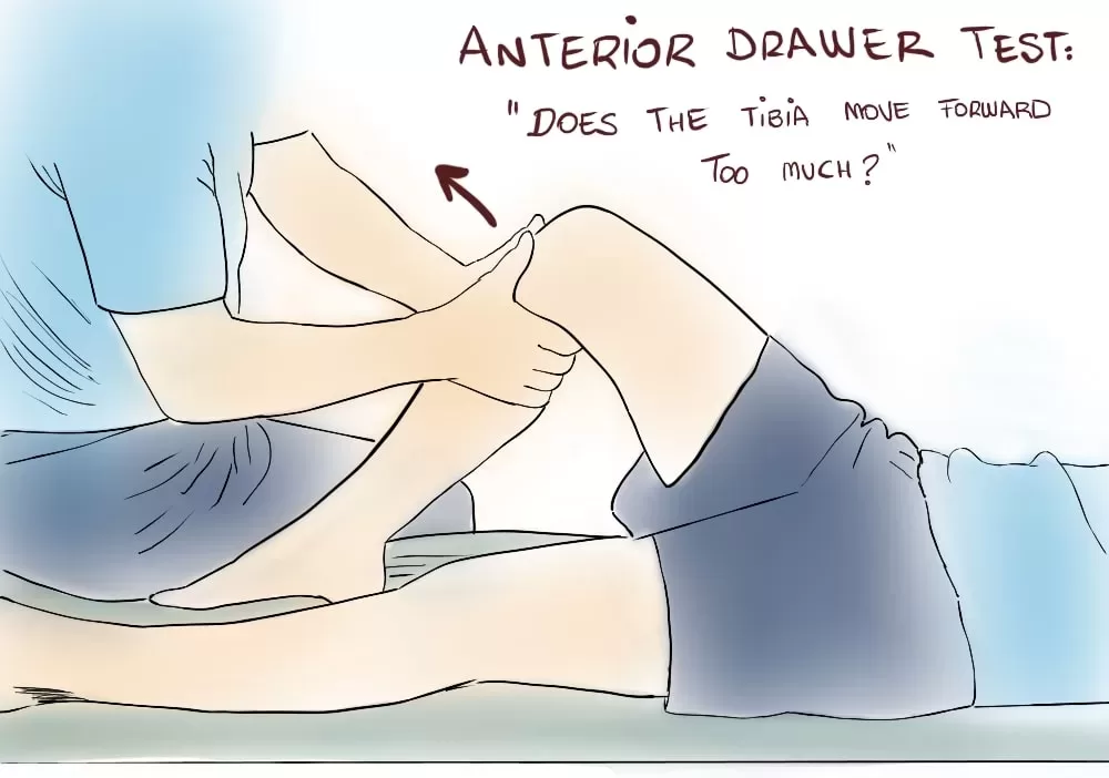 Anterior drawer test for diagnosis of ACL tear