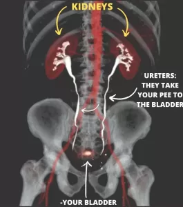 CT of kidneys, ureters and bladder