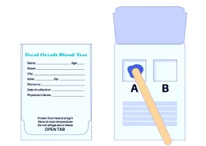 Fecal occult blood test