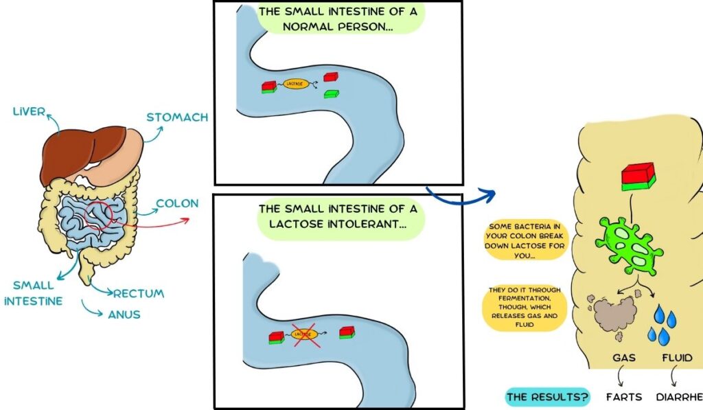 diagram showing why lactose intolerance happens