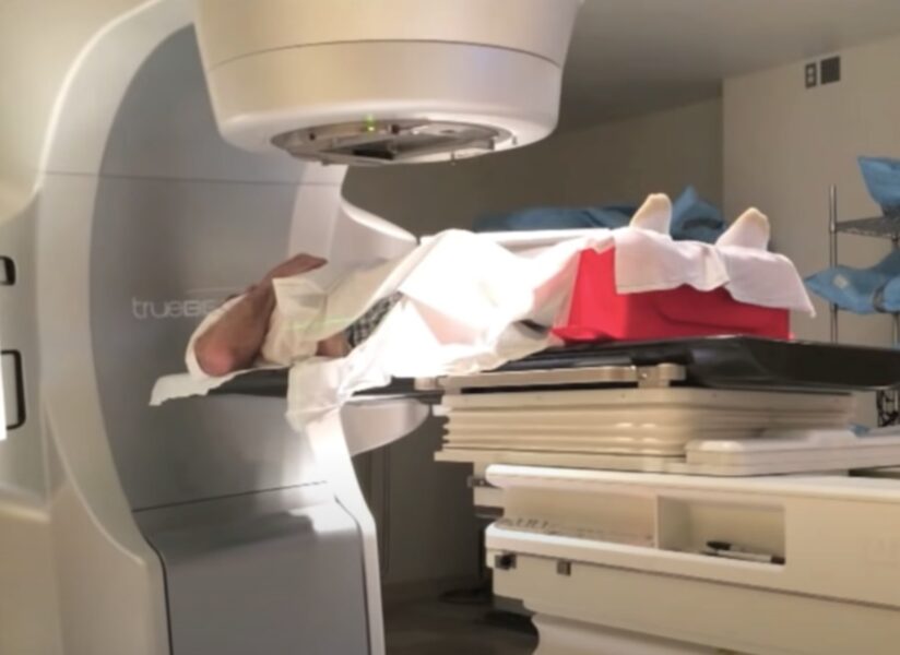 How Does Radiation Therapy Work For Prostate Cancer Pro Doctor